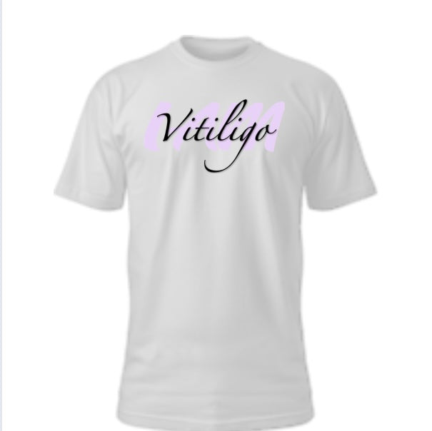 I AM Vitiligo T-shirt