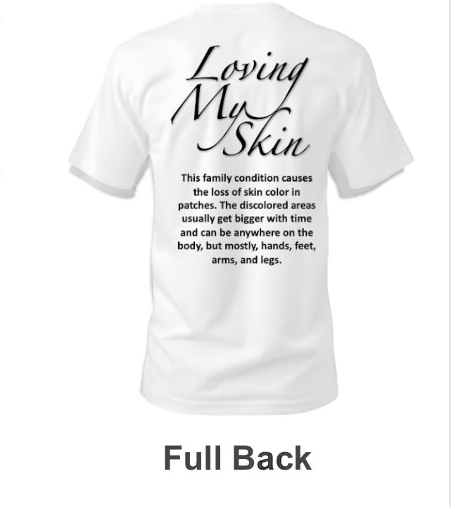 Confidence Vitiligo T-shirt