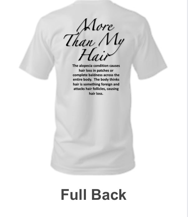 Capable Alopecia T-shirt Meaning
