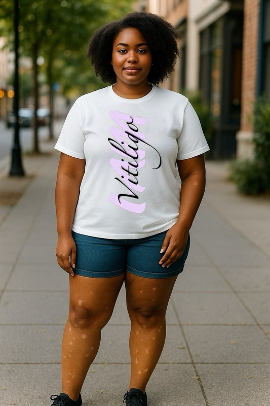I AM Vitiligo T-shirt